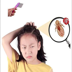 Lice Comb For Women And Kids | Stainless Steel(Ju, Joo, Zu) Lice Terminator | Fine Egg Nit Lice Egg Removal Comb For Women | Lice Comb For Scalp - Louse And Eggs Remover - HANDLE SHAPE