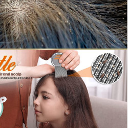 Lice Comb For Women And Kids | Stainless Steel(Ju, Joo, Zu) Lice Terminator | Fine Egg Nit Lice Egg Removal Comb For Women | Lice Comb For Scalp - Louse And Eggs Remover - ROUND SHAPE