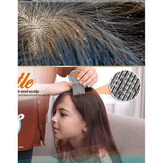 Lice Comb For Women And Kids | Stainless Steel(Ju, Joo, Zu) Lice Terminator | Fine Egg Nit Lice Egg Removal Comb For Women | Lice Comb For Scalp - Louse And Eggs Remover - ROUND SHAPE