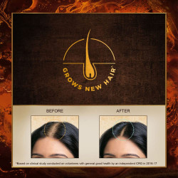 Indulekha Bringha Ayurvedic Hair Oil 50 ml, Hair Fall Control and Hair Growth with Bringharaj & Coconut Oil - Comb Applicator Bottle for Men & Women