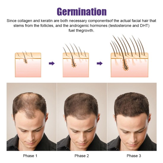 Derma Roller (0.25mm, 0.5mm, 1mm, 1.5mm, 2mm) with 540 Titanium Needles For Scalp, Face and Beard