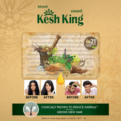 Kesh King Ayurvedic Anti Hairfall Hair Oil|Hair Growth Oil| Reduces Hairfall |21 Natural Ingredients | Grows New Hair With Bhringraja, Amla And Brahmi - 300 Ml